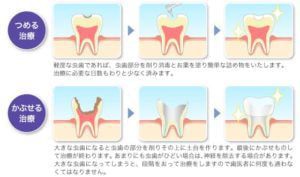一般歯科