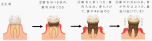 一般歯科