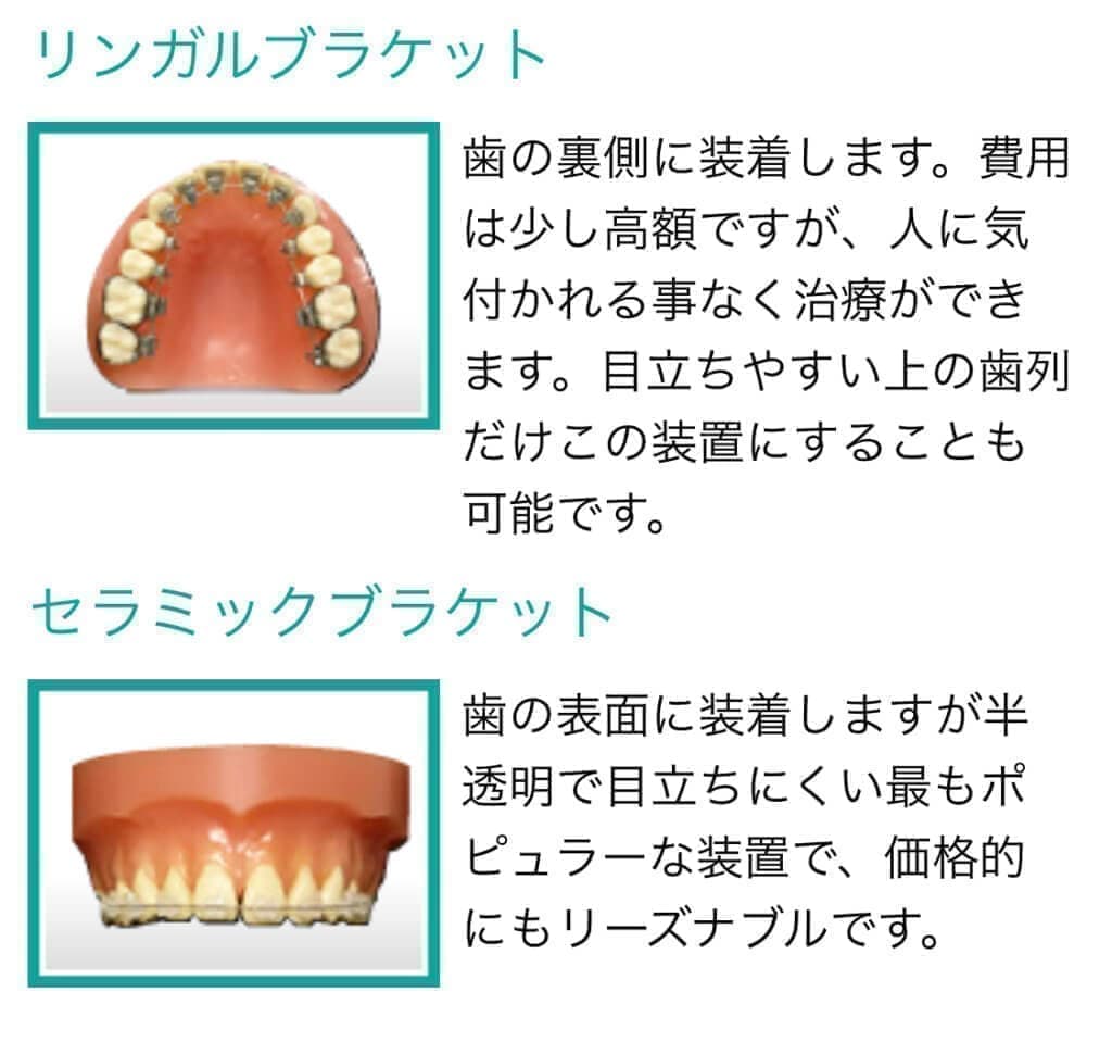 矯正歯科