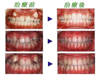 矯正歯科